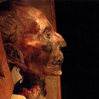 Mumie von Pharaos Ramses II. des Gro&szlig;en